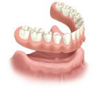 Eugene V. Meyerding Jr. Offer Removable Full Dentures in Medford, OR